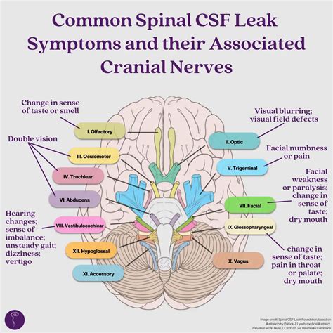 csf leaking from ears|Cerebrospinal fluid (CSF) leak: Symptoms, treatment,。